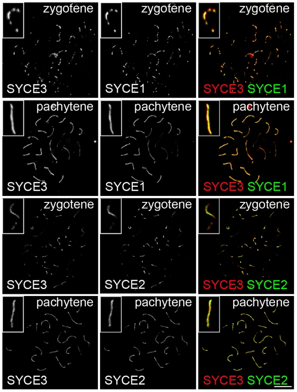 SYCE3 mirrors SYCE1 localization.