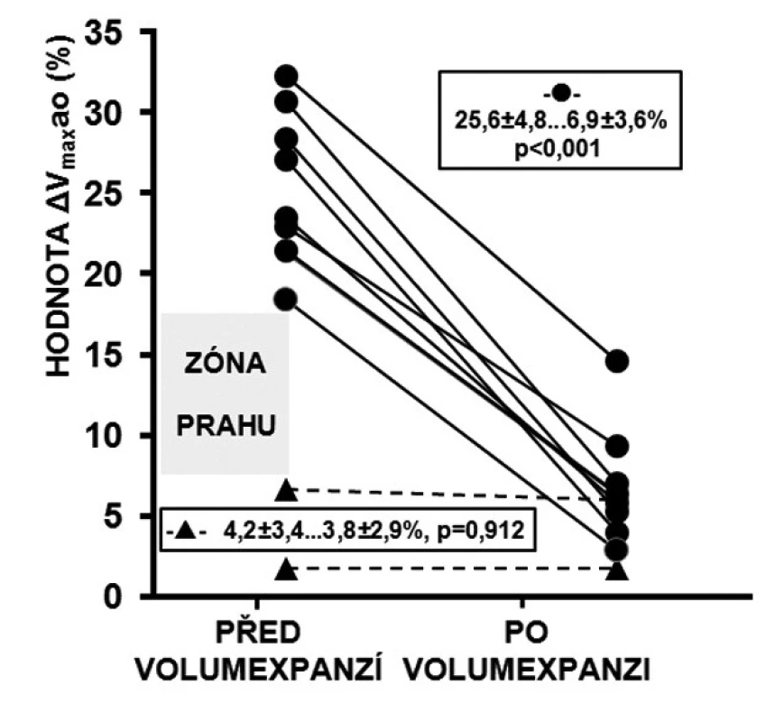 Reakce ΔVmaxao na volumexpanzi