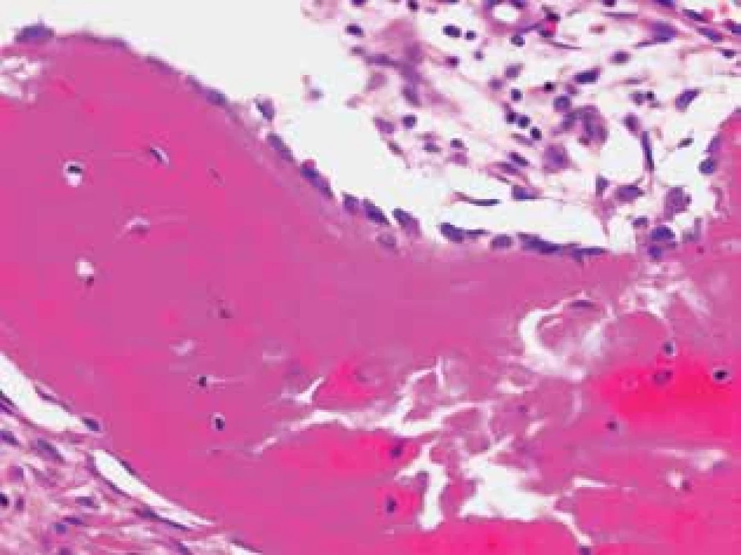 Histologický obraz lamelární kosti s periferním lemem osteoblastů a naznačeným Haversovým systémem