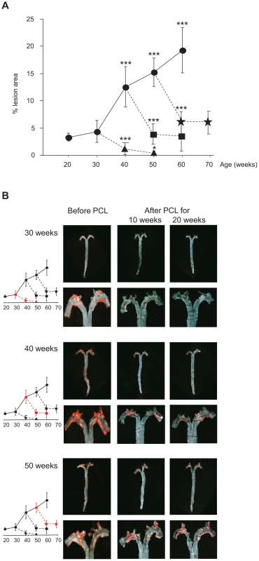Atherosclerosis progression in <i>Ldlr<sup>−/−</sup>Apob</i><sup>100/100</sup><i>Mttp</i><sup>flox/flox</sup> mice and regression in <i>Ldlr<sup>−/−</sup>Apob</i><sup>100/100</sup><i>Mttp</i><sup>Δ/Δ</sup> mice.