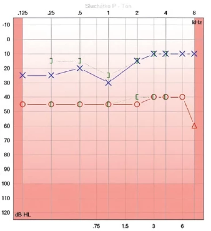 Audiogram, duben 2024.  Fig. 2. Audiogram, April 2024.