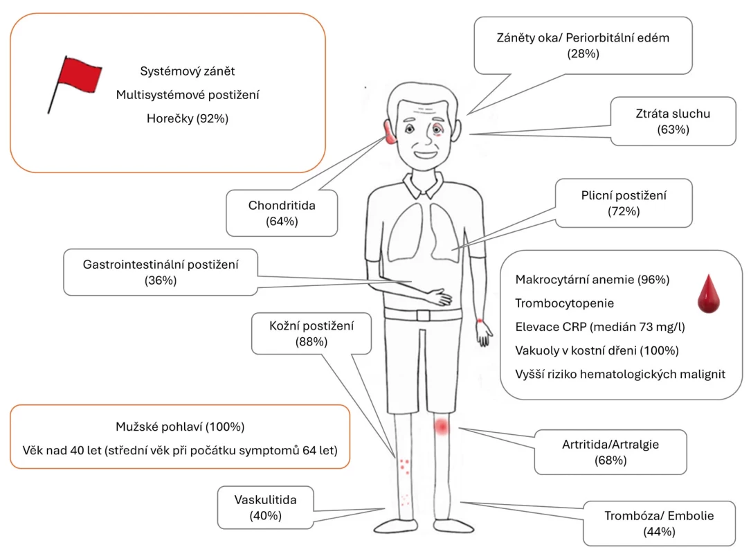 Nejčastější projevy syndromu VEXAS a jejich prevalence (dle 1)