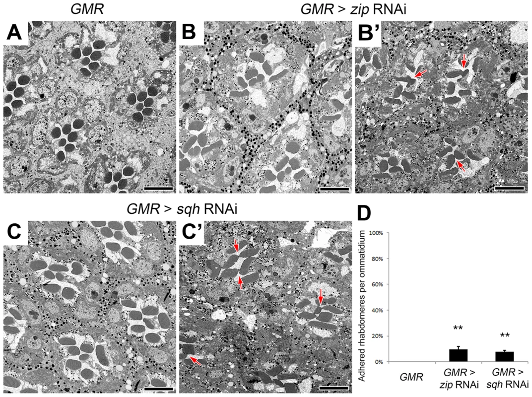 Non-muscle myosin II is required for retinal lumen formation.