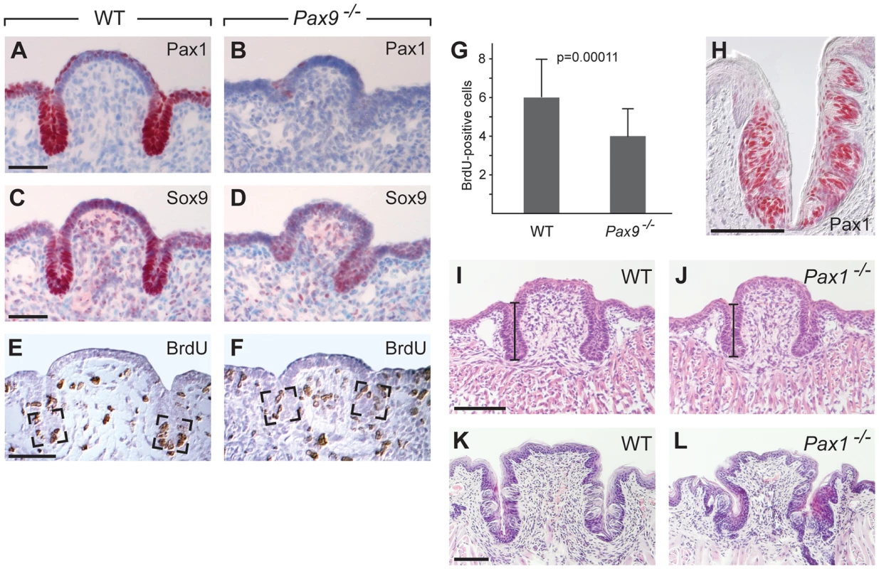 <i>Pax1</i> and <i>Sox9</i> are <i>Pax9</i> targets in the proliferating compartment of the CVP trenches.