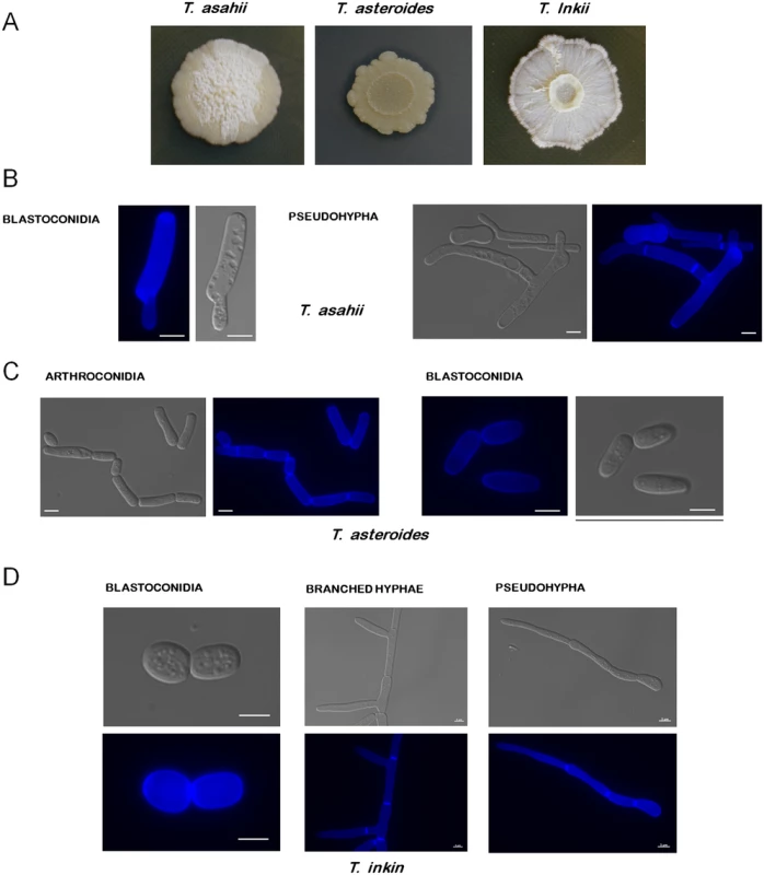 Colony morphology of <i>Trichosporon</i> species.