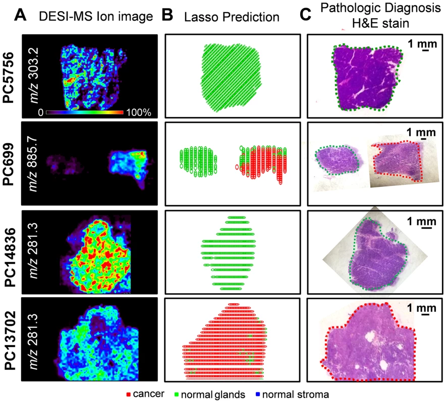 Selected DESI-MSI ion image and Lasso prediction results obtained for training samples PC5756 and PC699 and validation samples PC14836 and PC13702.