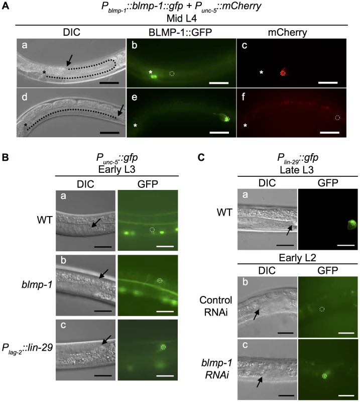 Effects of heterochronic mutations on the transcription of <i>unc-5</i> and <i>lin-29</i> in DTCs.