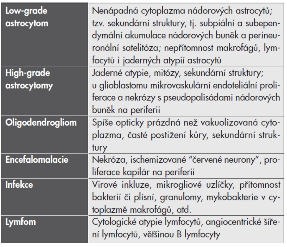 Diferenciální diagnostika tumoriformní demyelinizace.