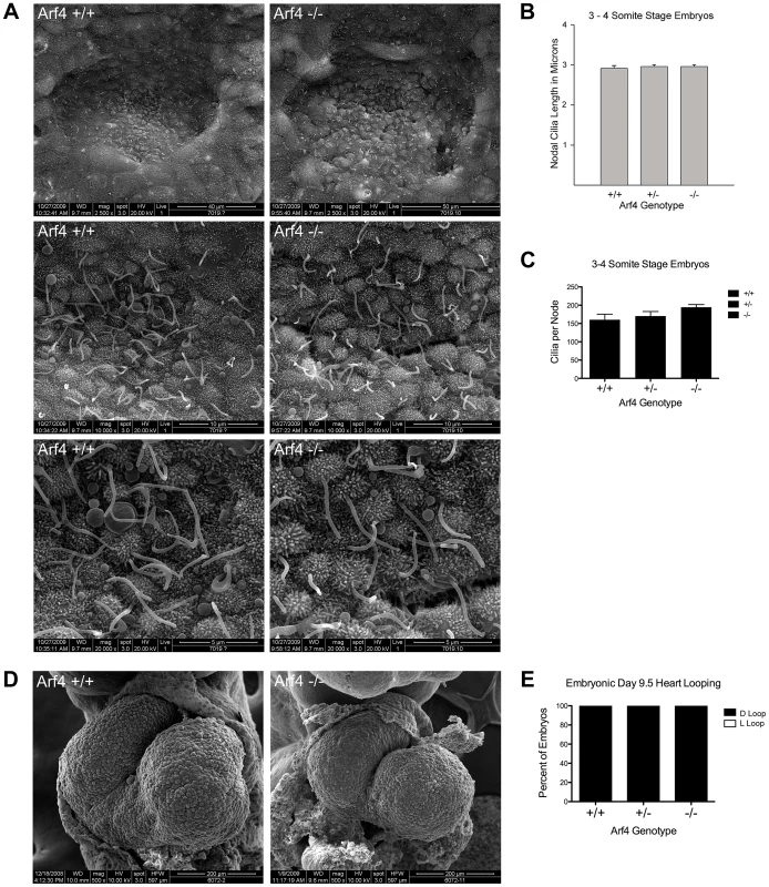 Arf4 mutant mice have functional nodal cilia.