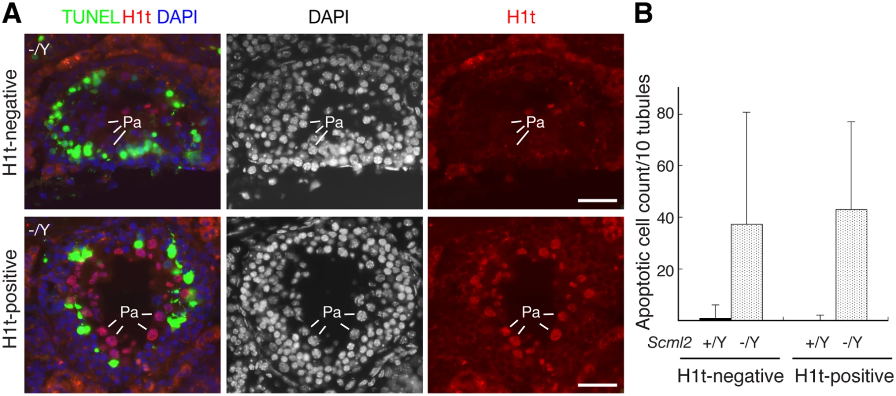 Apoptosis of spermatocytes in adult <i>Scml2</i><sup>-/Y</sup> testes.