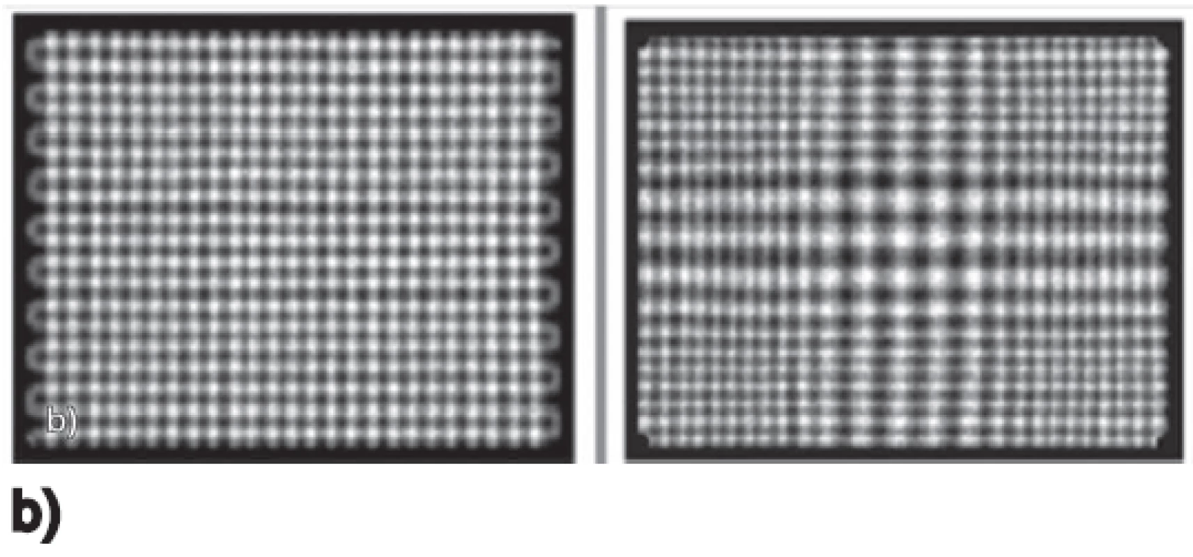 a) Schématické porovnání geometrie kolimátoru LEHR a SMARTZOOM, 
b) statický scintigram pravoúhlé mřížky ukazuje efekt kolimátoru – LEHR vlevo, SMARTZOOM vpravo.