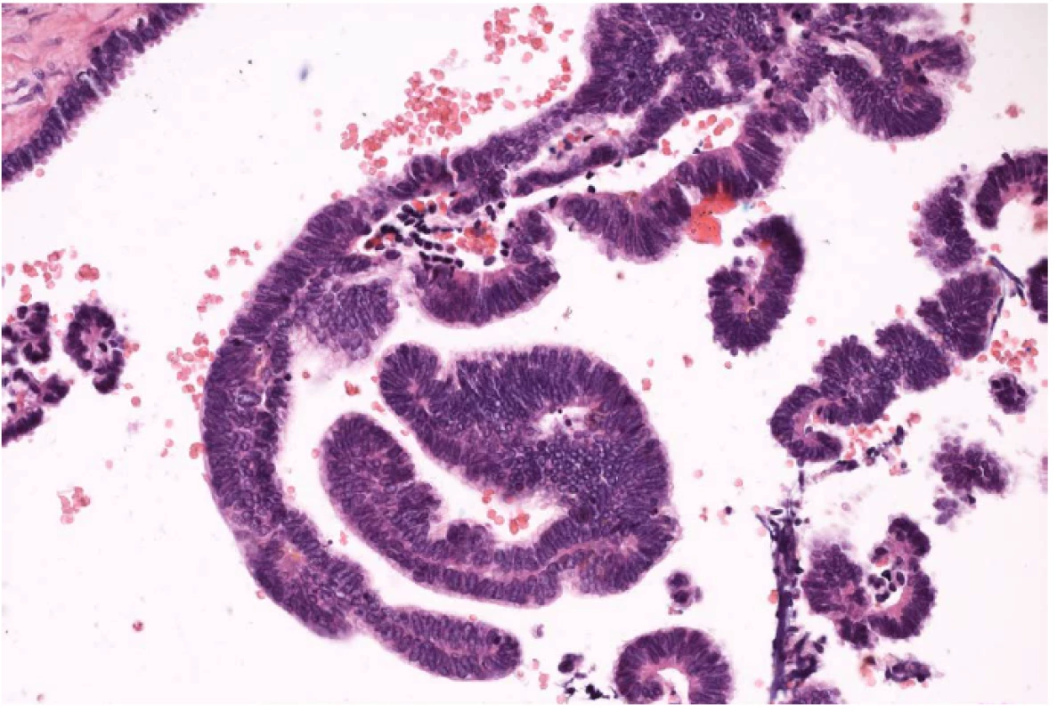 Detail histologického preparátu, papily kryté basofilním epitelem – zvětšeno 100x
Fig. 4 Detail of histological specimen, papillae covered with basophilic epithelium – 100 x magnification