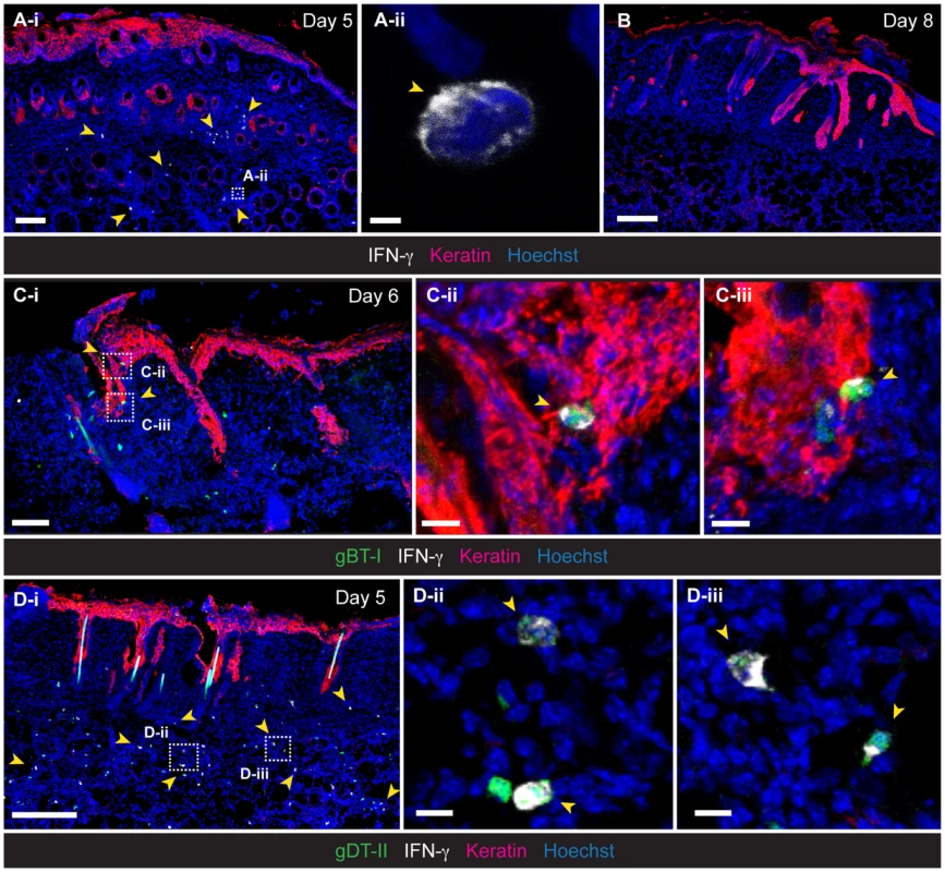Localization of IFN-γ<sup>+</sup> T<sub>EFF</sub> cells in infected skin.