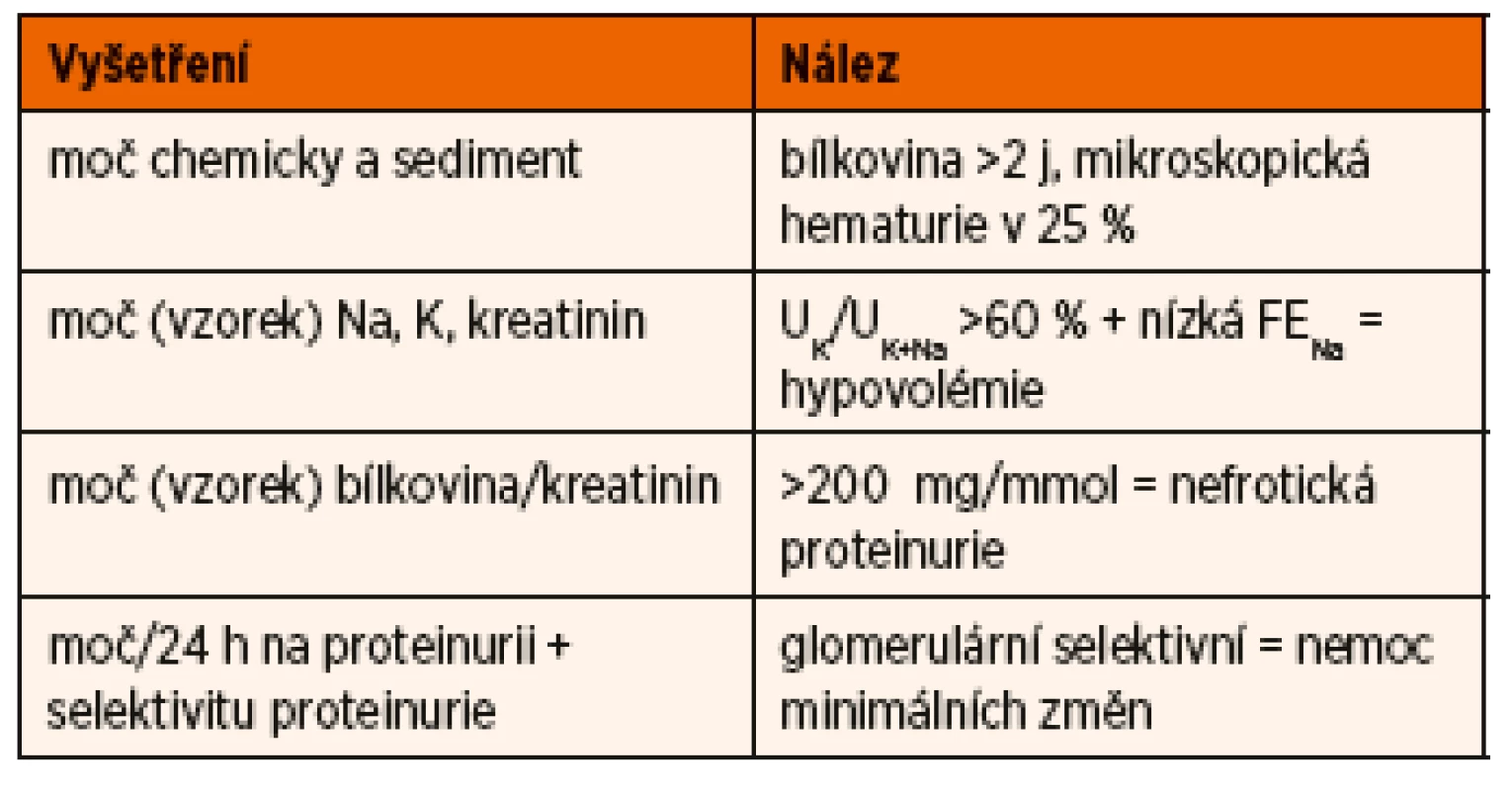 Vyšetření moče u dítěte s nefrotickým syndromem.