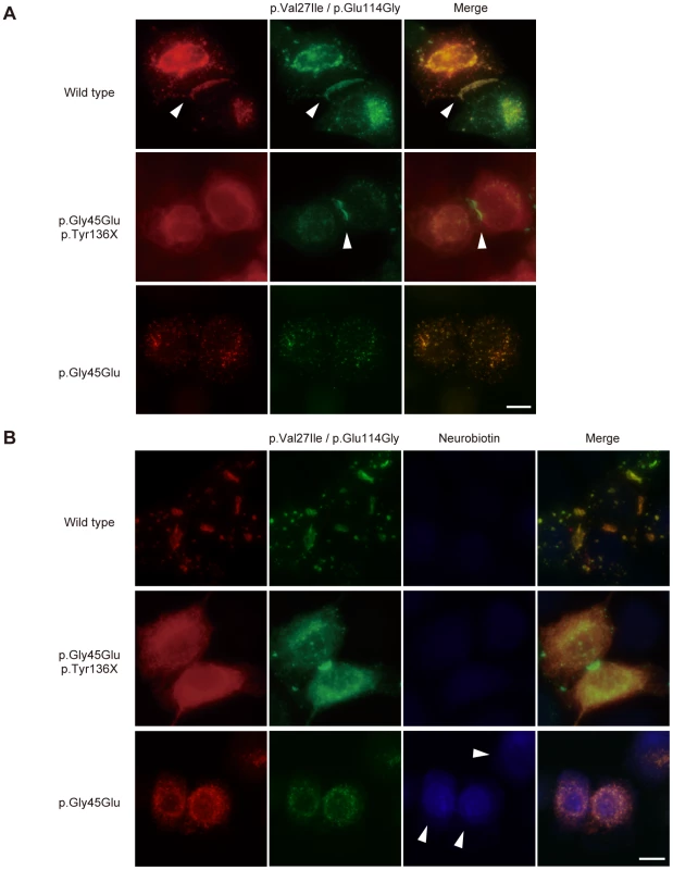 The p.Tyr136X mutation confines the effect of the pGly45Glu mutation.