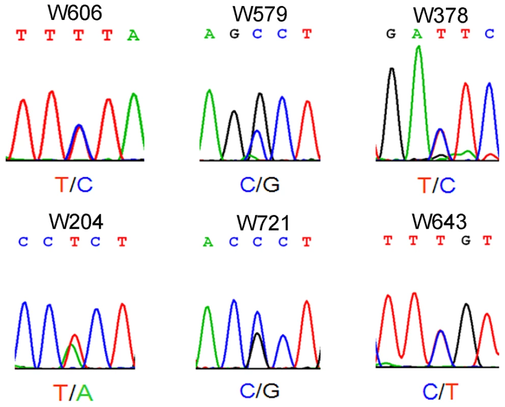 Electropherogram showing single-nucleotide mutation of <i>WT1</i> in patients with non-obstructive azoospermia.