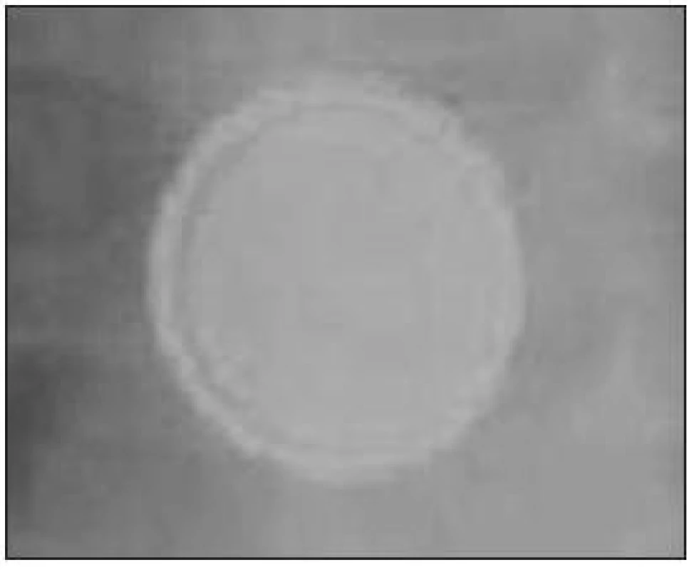 „Double ring“ efekt – dvojitá kontura po obvodu – typické pro baterii.
Fig. 3. „Double ring” effect – double outline around – typical for battery.