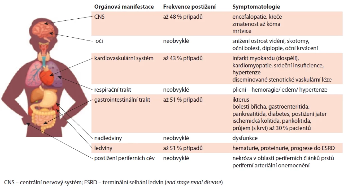 Frekvence postižení a příznaky TMA u pediatrických pacientů, zpracováno podle [9,14].