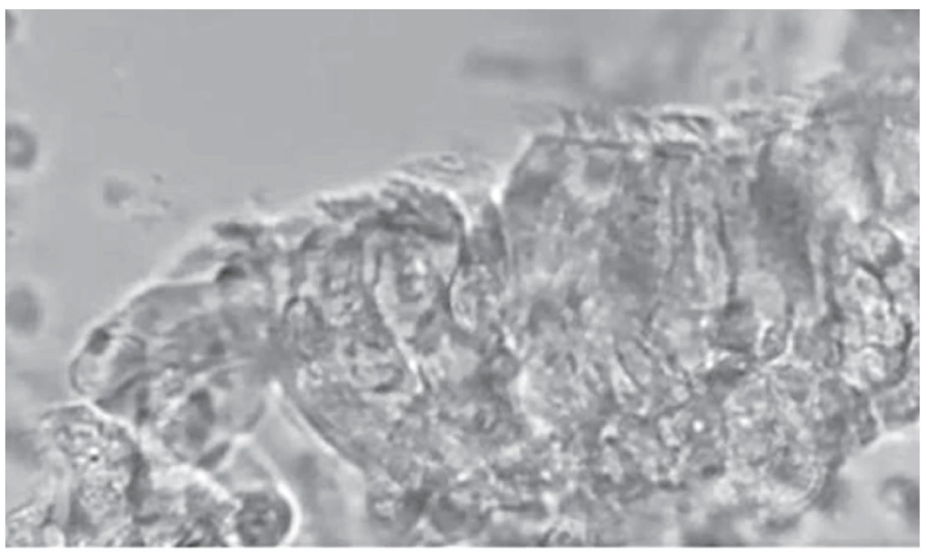 Statický obraz získaný při HSVM.
Fig. 2. Still image obtained at HSVM.