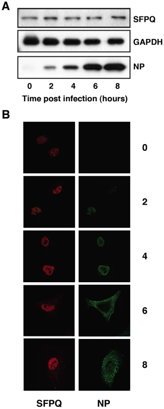 Accumulation and localisation of SFPQ/PSF in influenza virus infected cells.