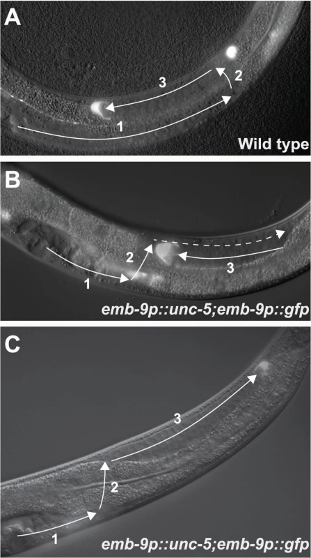 Over-expression of the UNC-6/Netrin receptor UNC-5 causes DTC phase 3 A/P polarity reversals.