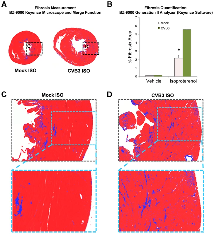 Increased fibrosis following beta-adrenergic stimulation-induced cardiac hypertrophy in adult mice infected with CVB3 at an early age.