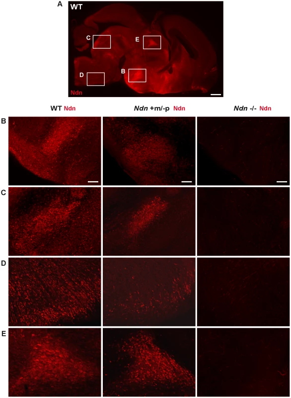 <i>Ndn</i> expression in <i>Ndn+m/−p</i> brains of neonates.