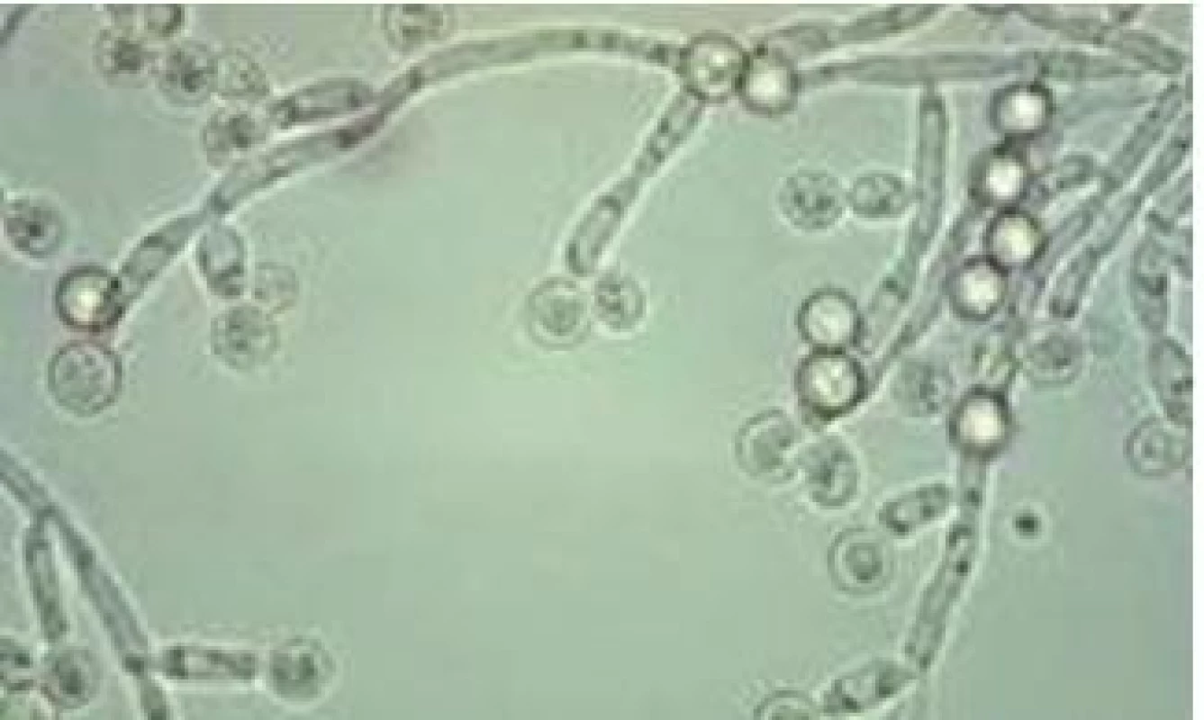 Candida albicans.