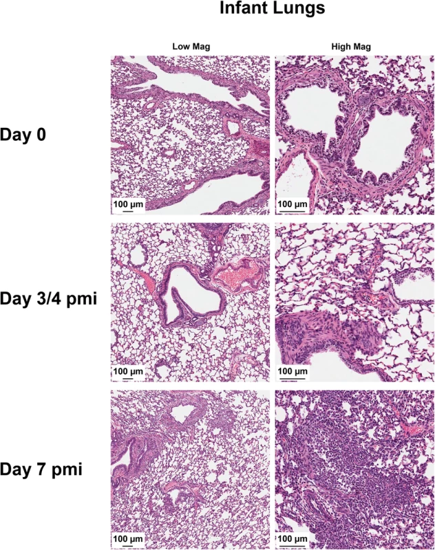 2009 H1N1 transmission from mothers to infants results in severe lower respiratory tract pathology.