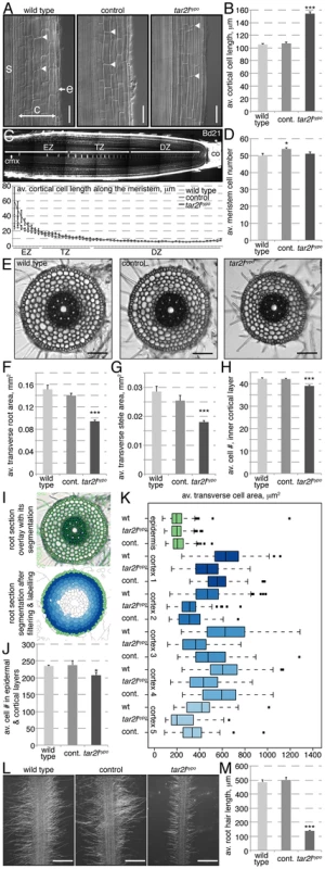 Cellular root phenotypes of <i>Bdtar2l<sup>hypo</sup></i> mutants.