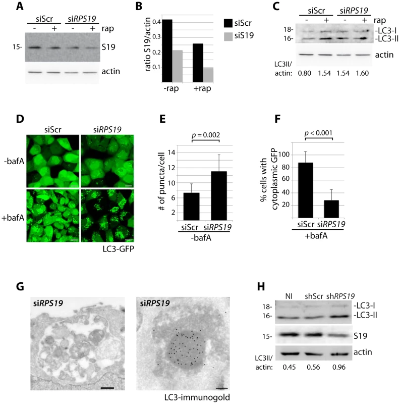 Knock down of <i>RPS19</i> induces autophagy.