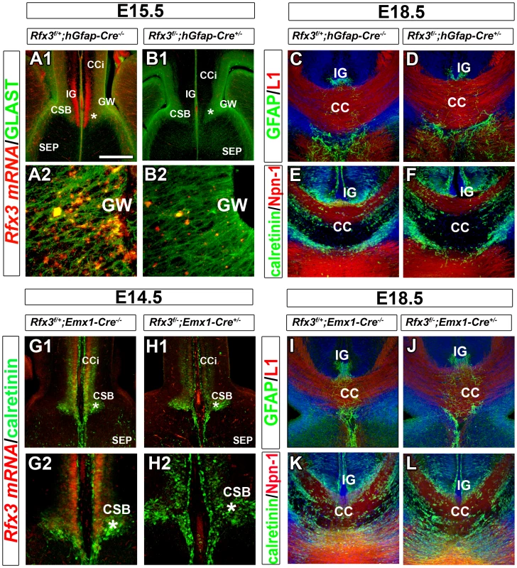Mice carrying a conditional deletion of <i>Rfx3</i> in guidepost cells have a normal corpus callosum.