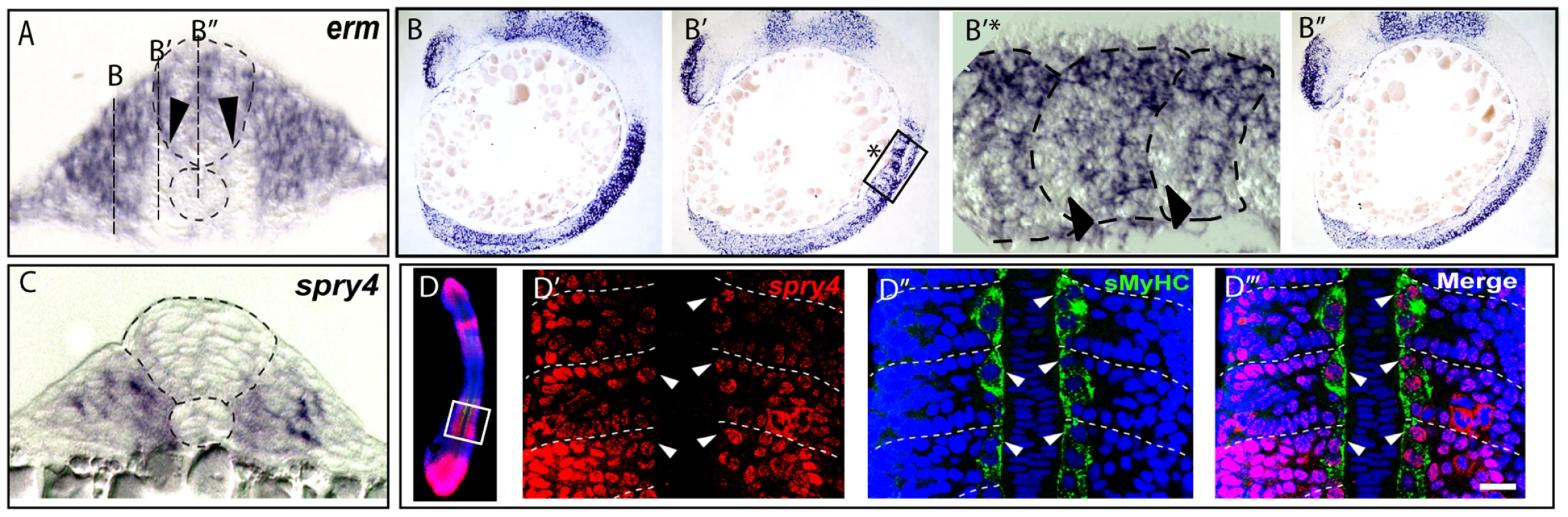 FGF signaling is down regulated in muscle pioneer precursor domain.