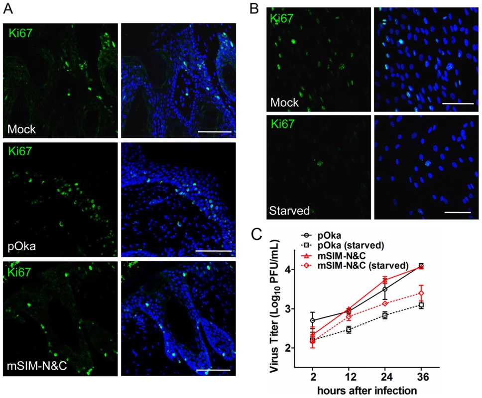 ORF61 SIMs are not required for VZV replication in non-proliferating cells <i>in vitro</i>.