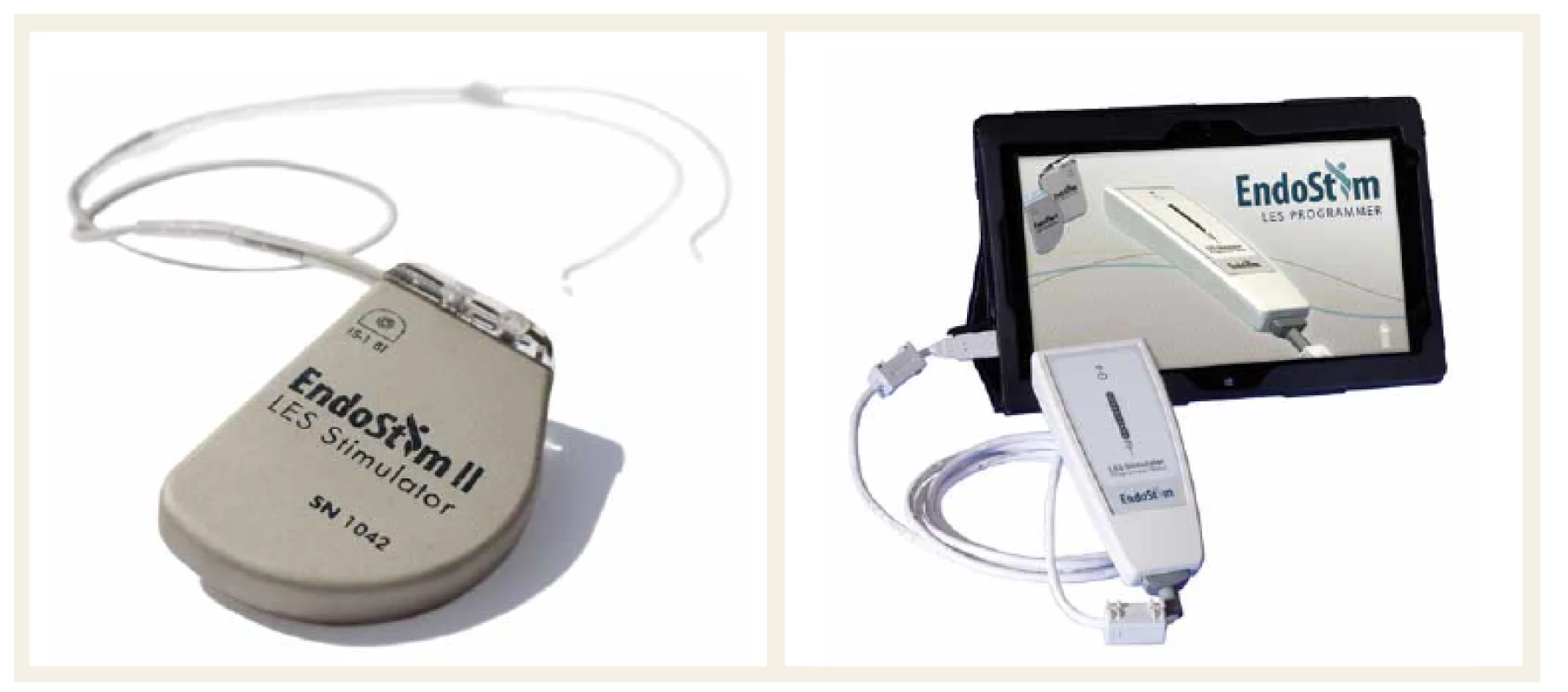 EndoStim – programovatelný implantabilní pulzní generátor, bipolární stimulační elektrody a externí bezdrátový programátor.
Fig. 1. EndoStim – a programmable implantable pulse generator, a bipolar stimulation lead with two stitch electrodes, and an external wireless programmer.