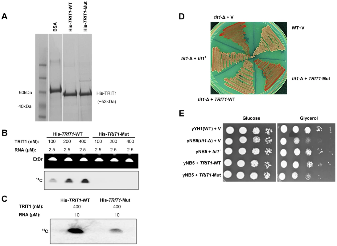 Mutant TRIT1 has decreased <i>in vitro</i> activity and cannot complement <i>tit1</i>-Δ defects in <i>S. pombe</i>.