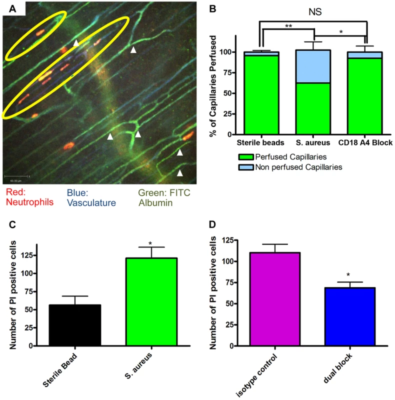 Occlusion of the capillary microvasculature and quantification of cell death following insertion of <i>S. aureus</i> bead.