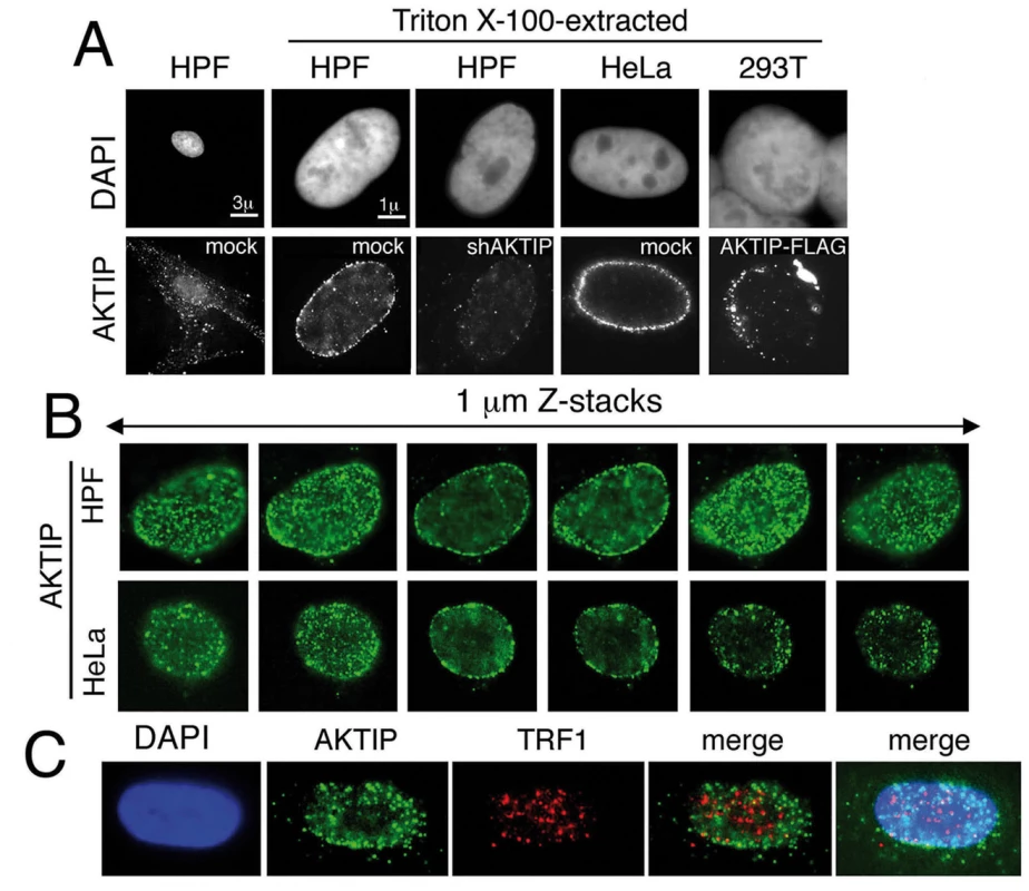 AKTIP localizes at the nuclear periphery.