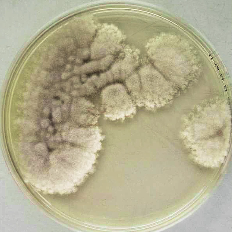 Kolonie izolátu <em>Scedosporium apiospermum</em> na Sabouraudově agaru (7 dnů, 37 °C) od našeho pacienta.