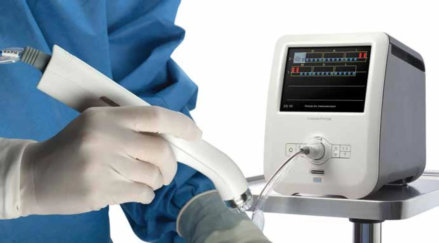 MarginProbe System. Převzato z [1].