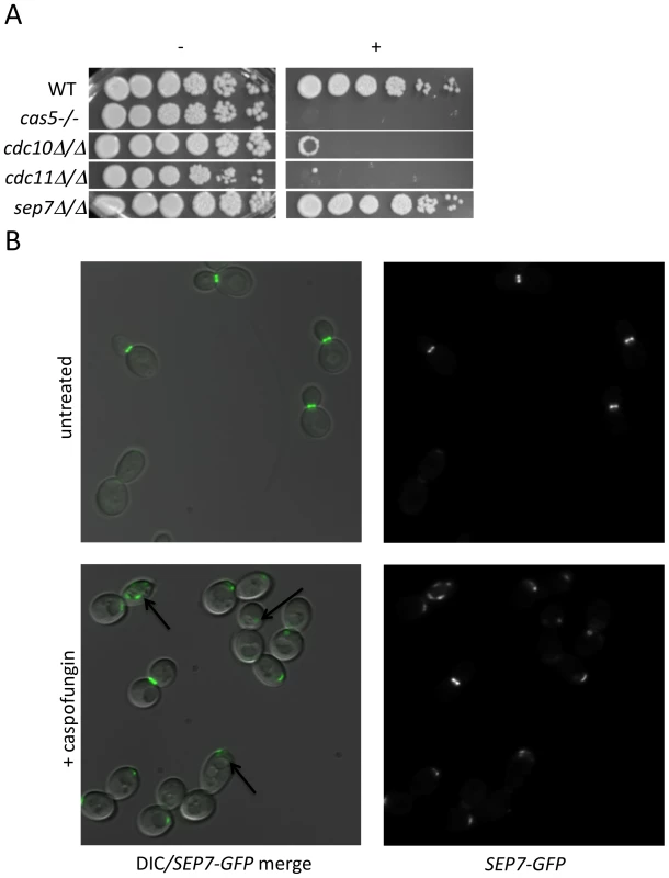 Septins play an integral role in CWR.