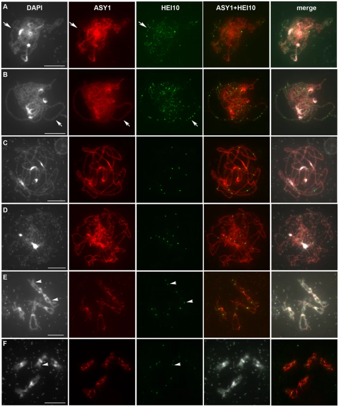 HEI10 can be detected on chromosomes throughout the entire meiotic prophase.