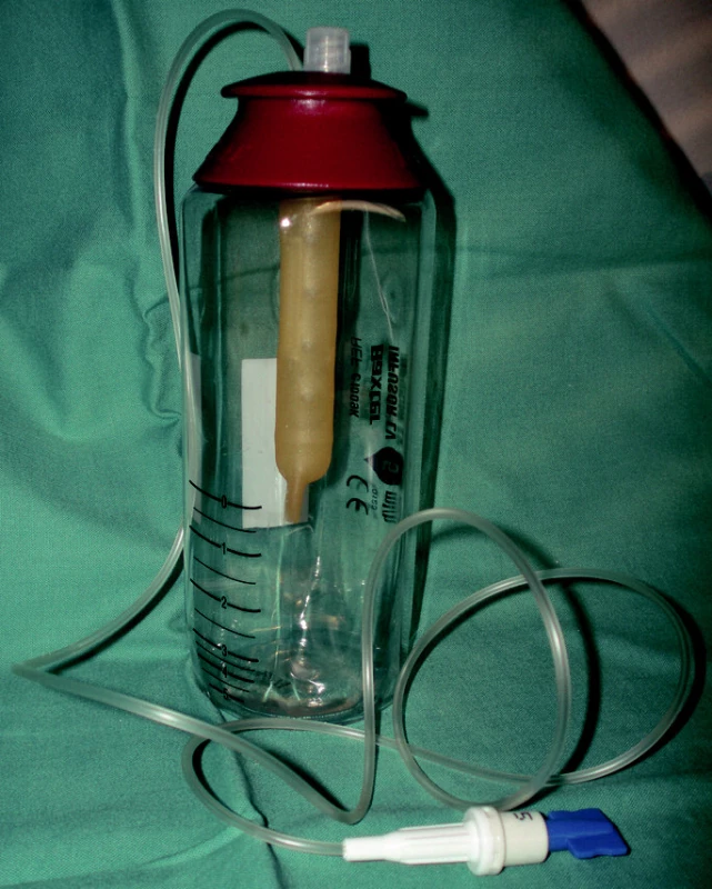 Infusor ke kontinuální i.v. aplikaci Desferalu