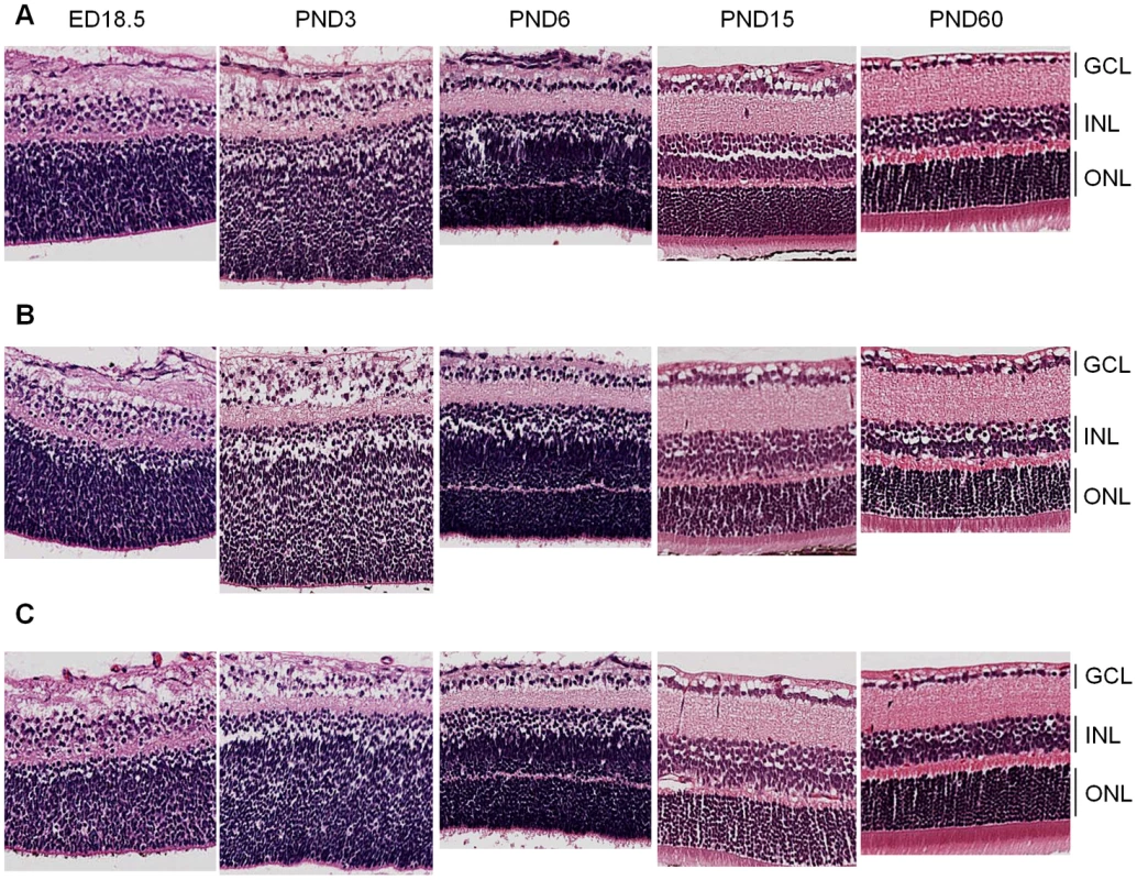 Retinal histology of <i>Cdh11</i><sup>+/+</sup>, <i>Cdh11</i><sup>+/-</sup>, and <i>Cdh11</i><sup>-/-</sup> littermates.