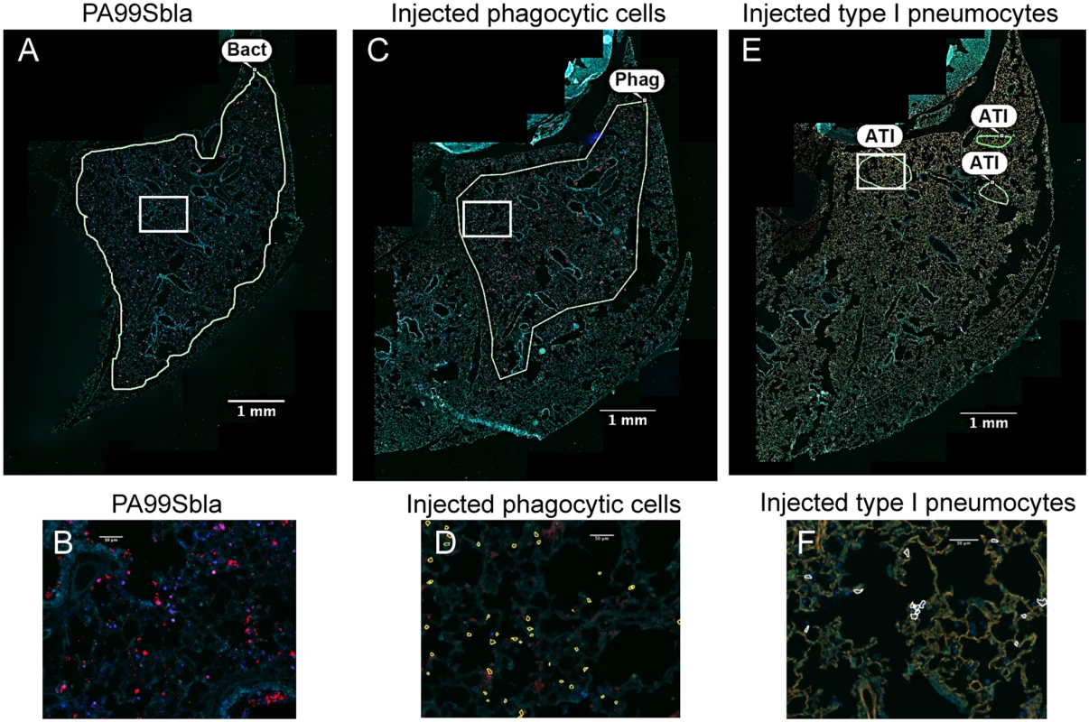 The distribution of injected type I pneumocytes differs from that of phagocytes or bacteria within lung lobes.