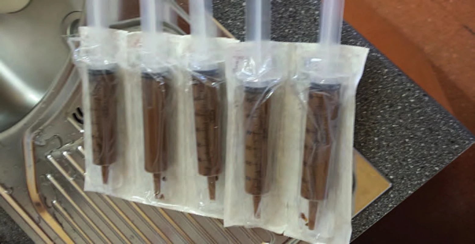 Fekální transplantát.
Fig. 2. Faecal transplant.