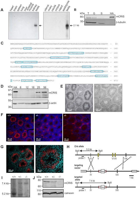 CRIS is exclusively expressed in sperm precursor-cells.