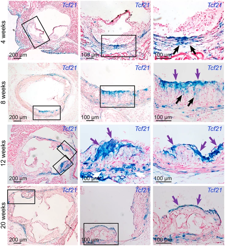 <i>Tcf21</i> expressing cells are found in atherosclerotic lesions.