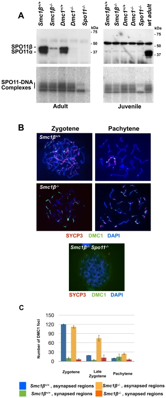 Normal formation but delayed processing of DNA DSBs in <i>Smc1β<sup>−/−</sup></i>spermatocytes.