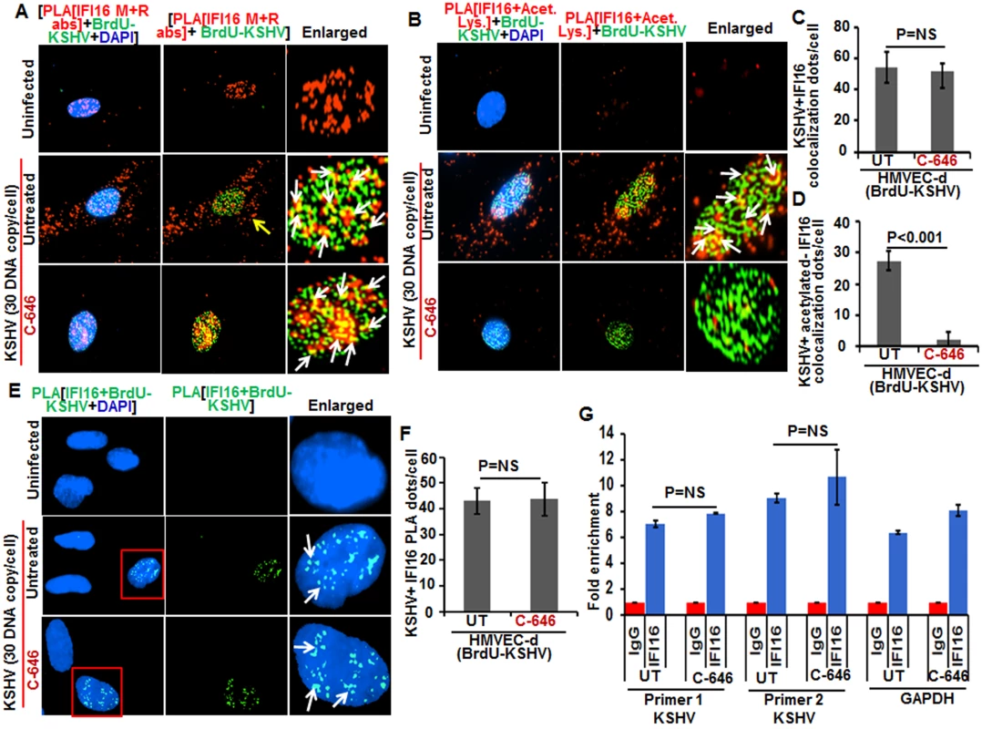 Effect of acetylation inhibition by C-646 on the ability of IFI16 to recognize and bind the KSHV genome.